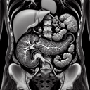 МРТ підшлункової залози